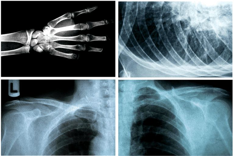 Ресей жұлдыздарының жақын көріністері Порно каннабис